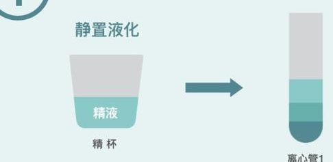 做泰国试管婴儿期间你能保持运动习惯吗？